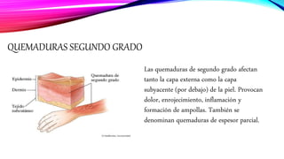 QUEMADURAS SEGUNDO GRADO
Las quemaduras de segundo grado afectan
tanto la capa externa como la capa
subyacente (por debajo) de la piel. Provocan
dolor, enrojecimiento, inflamación y
formación de ampollas. También se
denominan quemaduras de espesor parcial.
 