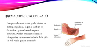 QUEMADURAS TERCER GRADO
Las quemaduras de tercer grado afectan las
capas profundas de la piel y también se
denominan quemaduras de espesor
completo. Pueden provocar coloración
blanquecina, oscura o carbonizada de la piel.
La piel puede quedar insensible.
 
