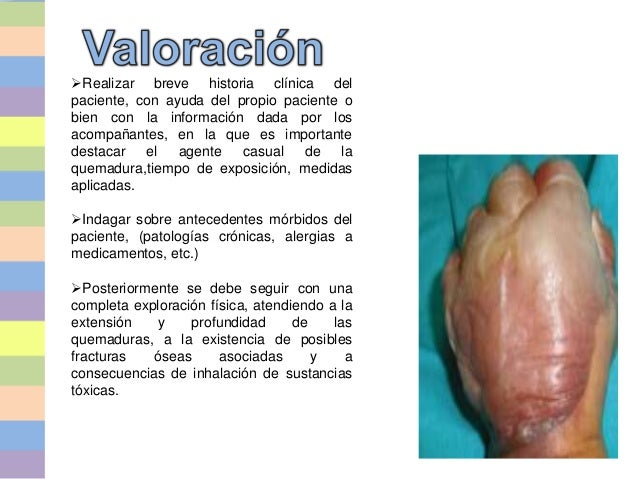 PACIENTE QUEMADO PEDIATRICO EBOOK PACIENTE QUEMADO PEDIATRICO EBOOK