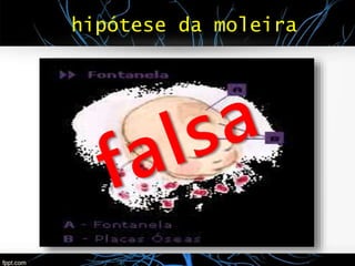 hipótese da moleira
 