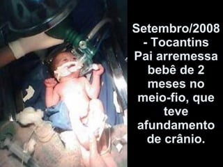 Setembro/2008 - Tocantins Pai arremessa bebê de 2 meses no meio-fio, que teve afundamento de crânio. 