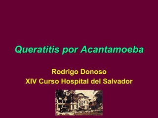 Queratitis por Acantamoeba Rodrigo Donoso XIV Curso Hospital del Salvador 