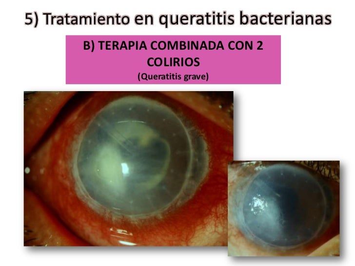 Ivomec pour on 10ml