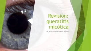Revisión:
queratitis
micótica
Dr. Alexander Naranjo Noboa
 