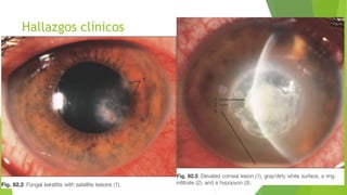 Hallazgos clínicos
 