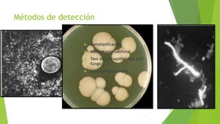 Métodos de detección
 Tinción
 Gram
 KOH
 Giemsa
 Blanco calcofluor
 Cultivo
 PCR
 Genotipificación
 Microscopía confocal
 Test de susceptibilidad anti
fúngica
 Smartphone images
 