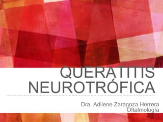 QUERATITIS
NEUROTRÓFICA
Dra. Adilene Zaragoza Herrera
Oftalmología