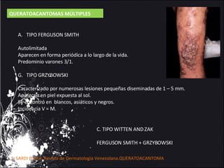 QUERATOACANTOMAS MÚLTIPLES TIPO FERGUSON SMITH Autolimitada Aparecen en forma periódica a lo largo de la vida. Predominio varones 3/1. TIPO GRZYBOWSKI Caracterizado por numerosas lesiones pequeñas diseminadas de 1 – 5 mm. Aparecen en piel expuesta al sol. SE encontró en  blancos, asiáticos y negros. Incidencia V = M. C. TIPO WITTEN AND ZAK FERGUSON SMITH + GRZYBOWSKI 1.  SARDI B José. Revista de Dermatología Venezolana.QUERATOACANTOMA 