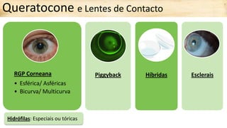 Piggyback Rgp Queratocone e Lentes de Contacto.pdf