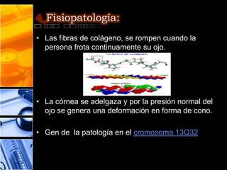 4_Fisiopatología:

• Las fibras de colágeno, se rompen cuando la
  persona frota continuamente su ojo.




• La córnea se adelgaza y por la presión normal del
  ojo se genera una deformación en forma de cono.

• Gen de la patología en el cromosoma 13Q32
 