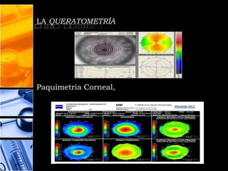LA QUERATOMETRÍA




Paquimetria Corneal,
 