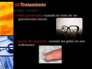 10-Tratamiento

» Gafas graduadas: cuando se trata de un
   queratocono inicial.




» Lentes de contacto:, cuando las gafas no son
  suficientes.
 