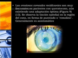 • Las erosiones corneales recidivantes son muy
  frecuentes en pacientes con queratocono, aún
  existiendo una adaptación óptima (Figura 9)
  (13). Se observa la tinción epitelial en la región
  del cono, en forma de punteado o "remolino".
  Generalmente es asintomático
 