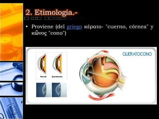 2. Etimología.-
• Proviene (del griego κέρατο- "cuerno, córnea" y
  κῶνος "cono")
 