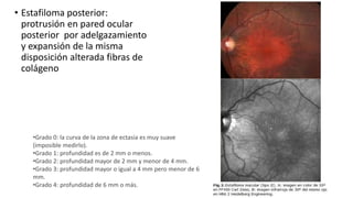 • Estafiloma posterior: 
protrusión en pared ocular 
posterior por adelgazamiento 
y expansión de la misma 
disposición alterada fibras de 
colágeno 
•Grado 0: la curva de la zona de ectasia es muy suave 
(imposible medirlo). 
•Grado 1: profundidad es de 2 mm o menos. 
•Grado 2: profundidad mayor de 2 mm y menor de 4 mm. 
•Grado 3: profundidad mayor o igual a 4 mm pero menor de 6 
mm. 
•Grado 4: profundidad de 6 mm o más. 
 