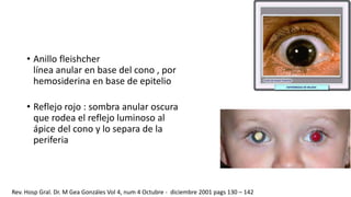 • Anillo fleishcher 
línea anular en base del cono , por 
hemosiderina en base de epitelio 
• Reflejo rojo : sombra anular oscura 
que rodea el reflejo luminoso al 
ápice del cono y lo separa de la 
periferia 
Rev. Hosp Gral. Dr. M Gea Gonzáles Vol 4, num 4 Octubre - diciembre 2001 pags 130 – 142 
 