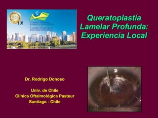 Queratoplastía Lamelar Profunda: Experiencia Local Dr. Rodrigo Donoso Univ. de Chile Clínica Oftalmológica Pasteur Santiago - Chile 
