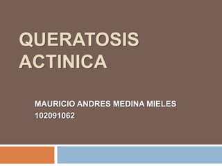 QUERATOSIS
ACTINICA

 MAURICIO ANDRES MEDINA MIELES
 102091062
 