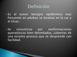    Es el tumor benigno epidérmico mas
    frecuente en adultos se localiza en la car y
    el tórax.

   Se     caracteriza  por    neoformaciones
    queratósicas bien delimitadas, cubiertas de
    una escama grasosa que se desprende con
    facilidad.
 