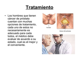 Tratamiento Los hombres que tienen cáncer de próstata cuentan con muchas opciones de tratamiento, cada uno de estos no necesariamente es adecuado para cada todos, el médico debe evaluar de acuerdo a su estado, cual es el mejor y el conveniente.  