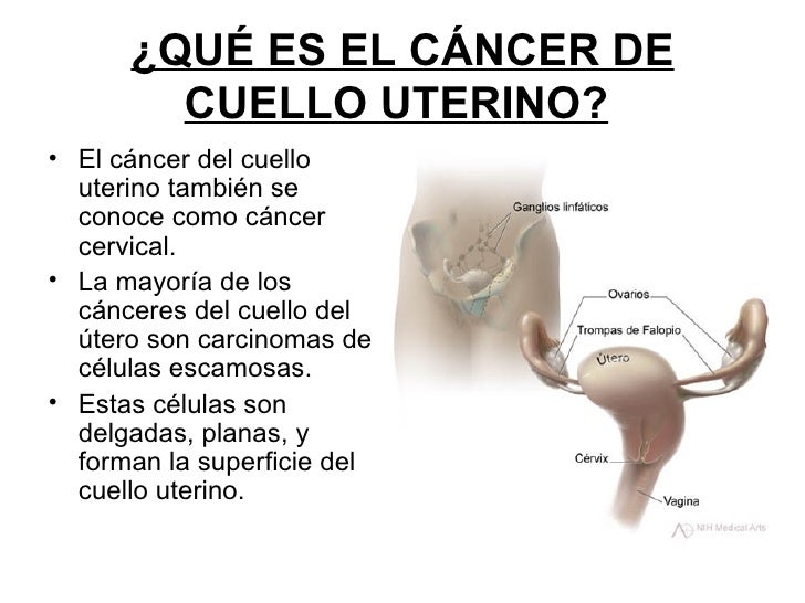 Que significa poner los pies detras del cuello