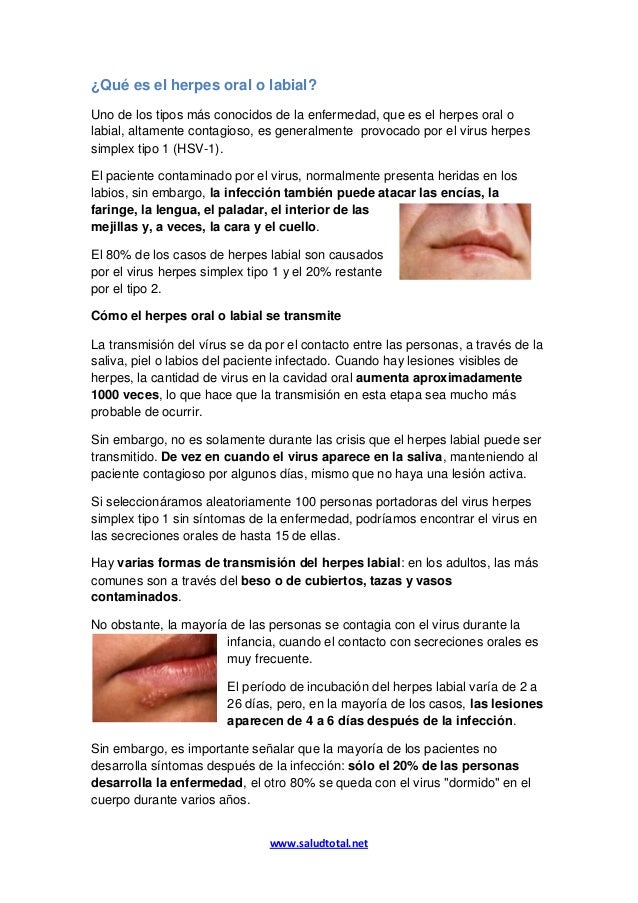 Que es el herpes oral