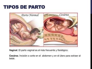 Qué es el Parto.pptx