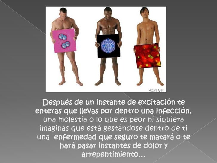 que-son-las-its