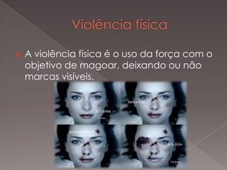 A violência física é o uso da força com o
objetivo de magoar, deixando ou não
marcas visíveis.