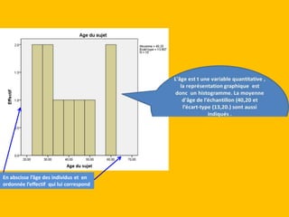 En abscisse l’âge des individus et en
ordonnée l’effectif qui lui correspond
 