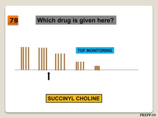 Which drug is given here?
TOF MONITORING
SUCCINYL CHOLINE
78
PREPP-19
 
