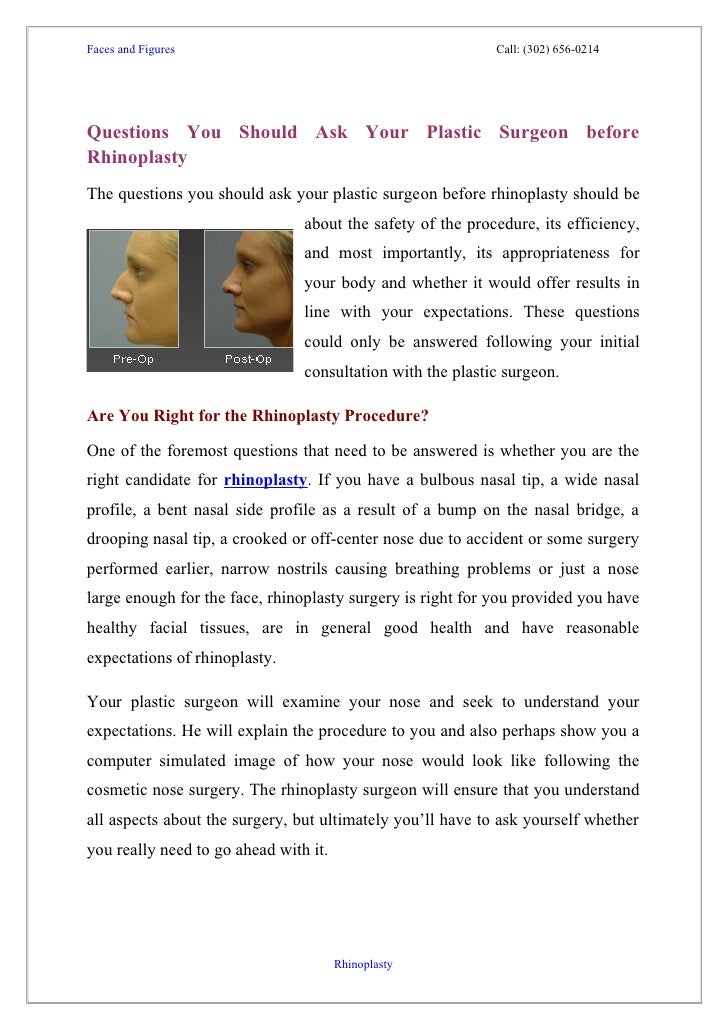 Questions you should ask your plastic surgeon before rhinoplasty