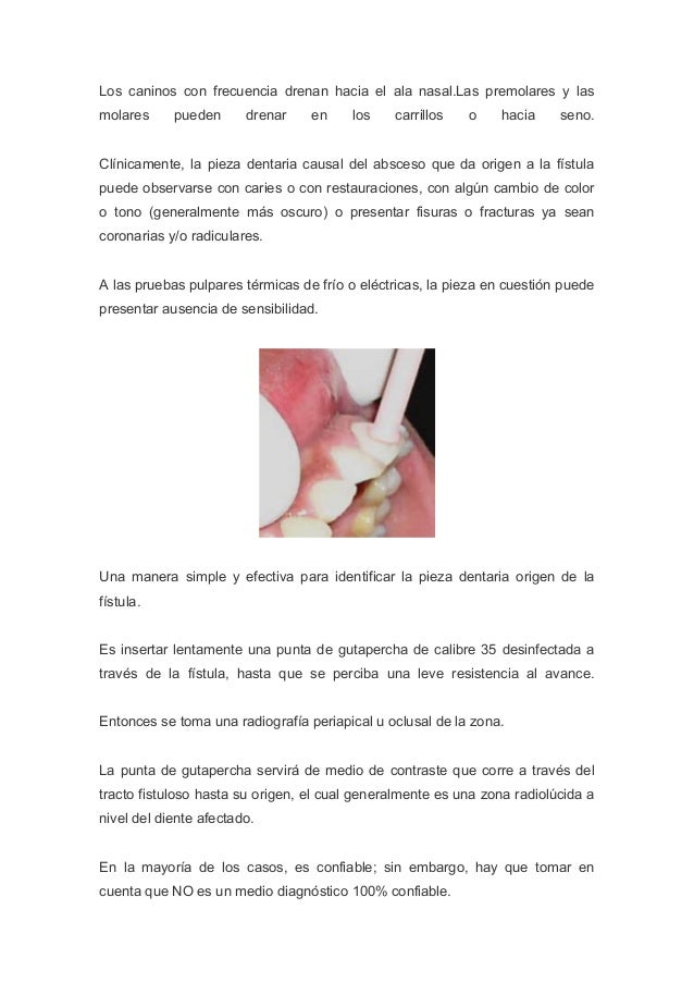 Qué es una fistula intraoral