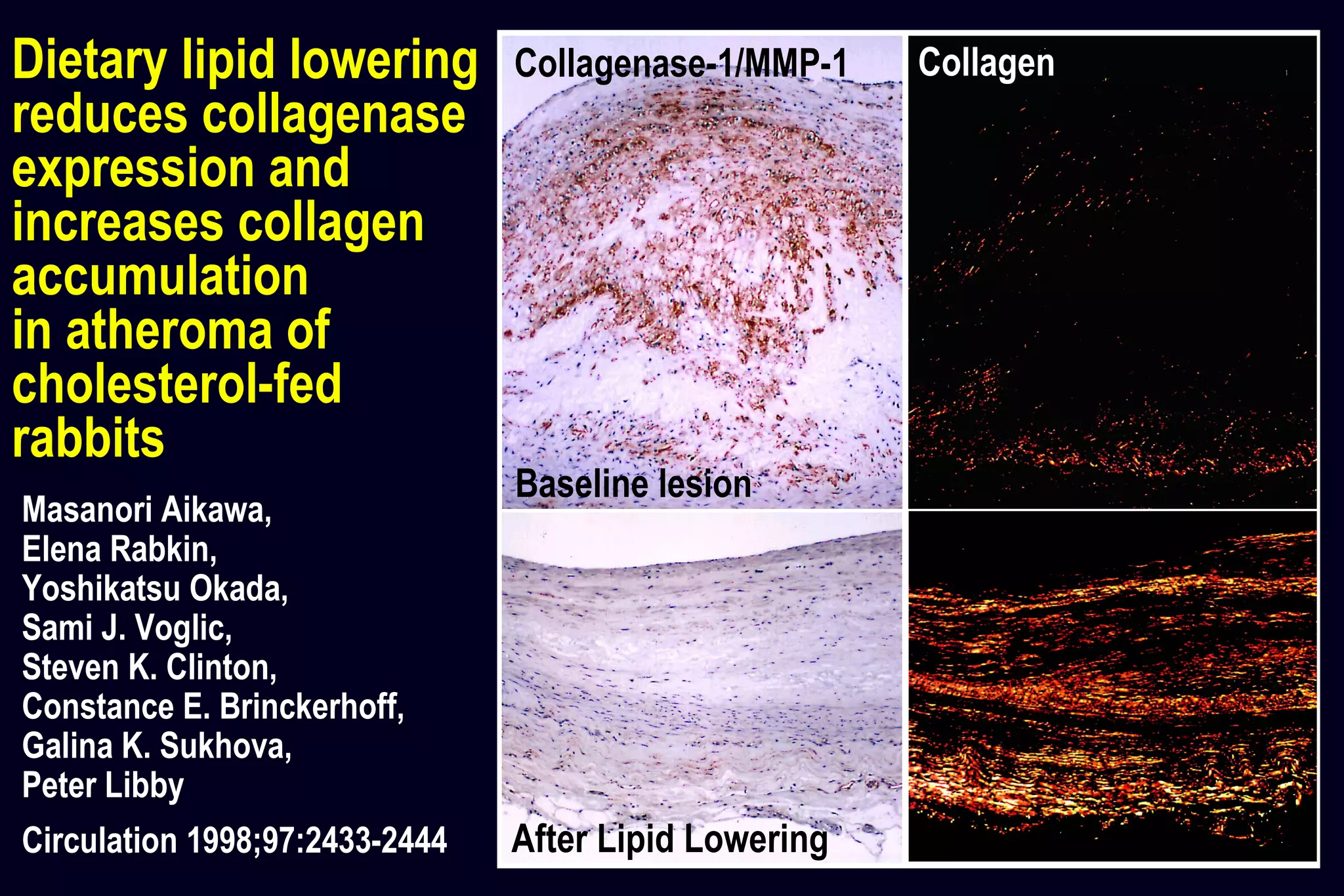 Collagen (Sirius red)
Masanori Aikawa,
Elena Rabkin,
Yoshikatsu Okada,
Sami J. Voglic,
Steven K. Clinton,
Constance E. Brinckerhoff,
Galina K. Sukhova,
Peter Libby
Circulation 1998;97:2433-2444
Dietary lipid lowering
reduces collagenase
expression and
increases collagen
accumulation
in atheroma of
cholesterol-fed
rabbits
Baseline lesion
Collagenase-1/MMP-1 Collagen
After Lipid Lowering
 