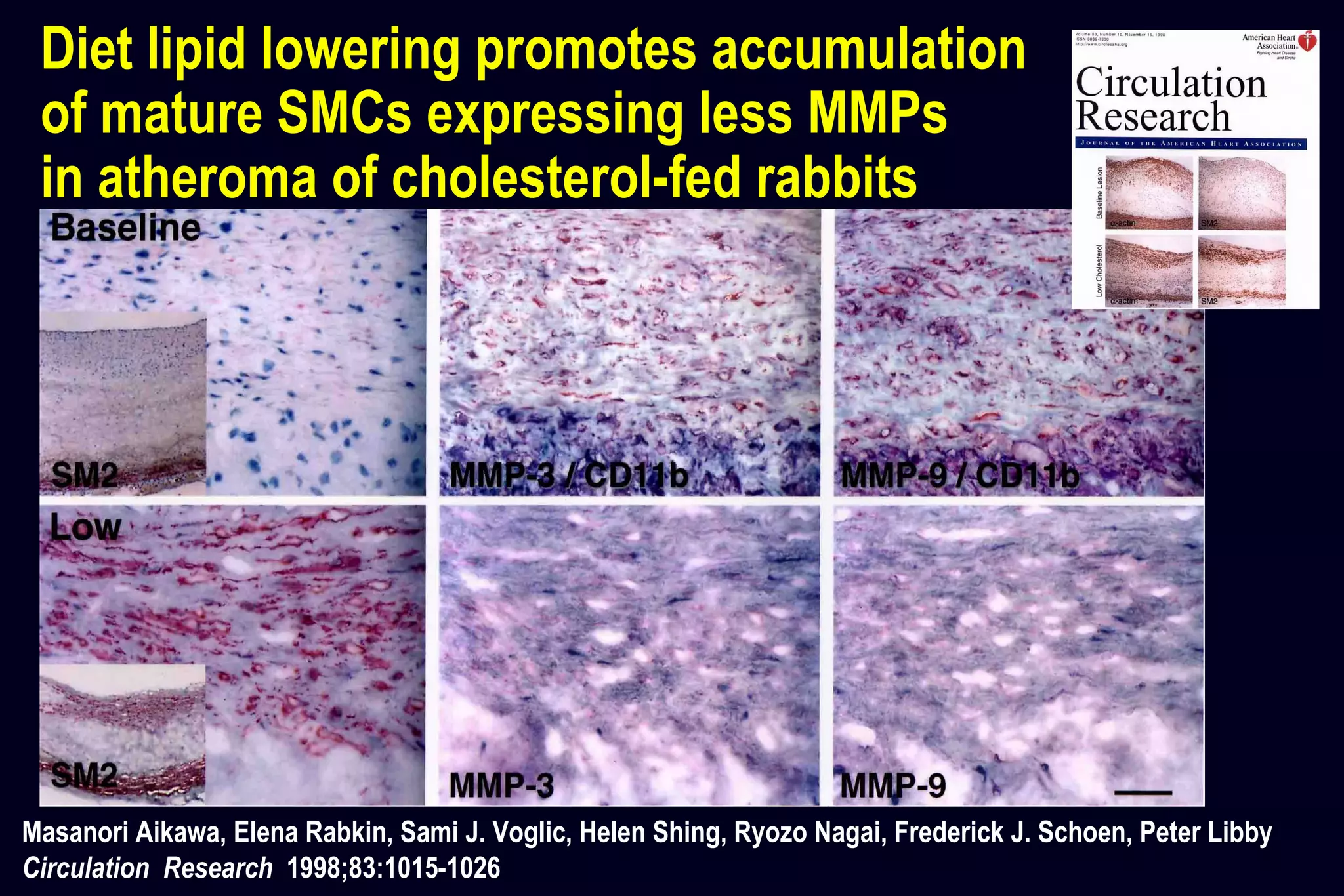 Diet lipid lowering promotes accumulation
of mature SMCs expressing less MMPs
in atheroma of cholesterol-fed rabbits
Masanori Aikawa, Elena Rabkin, Sami J. Voglic, Helen Shing, Ryozo Nagai, Frederick J. Schoen, Peter Libby
Circulation Research 1998;83:1015-1026
 