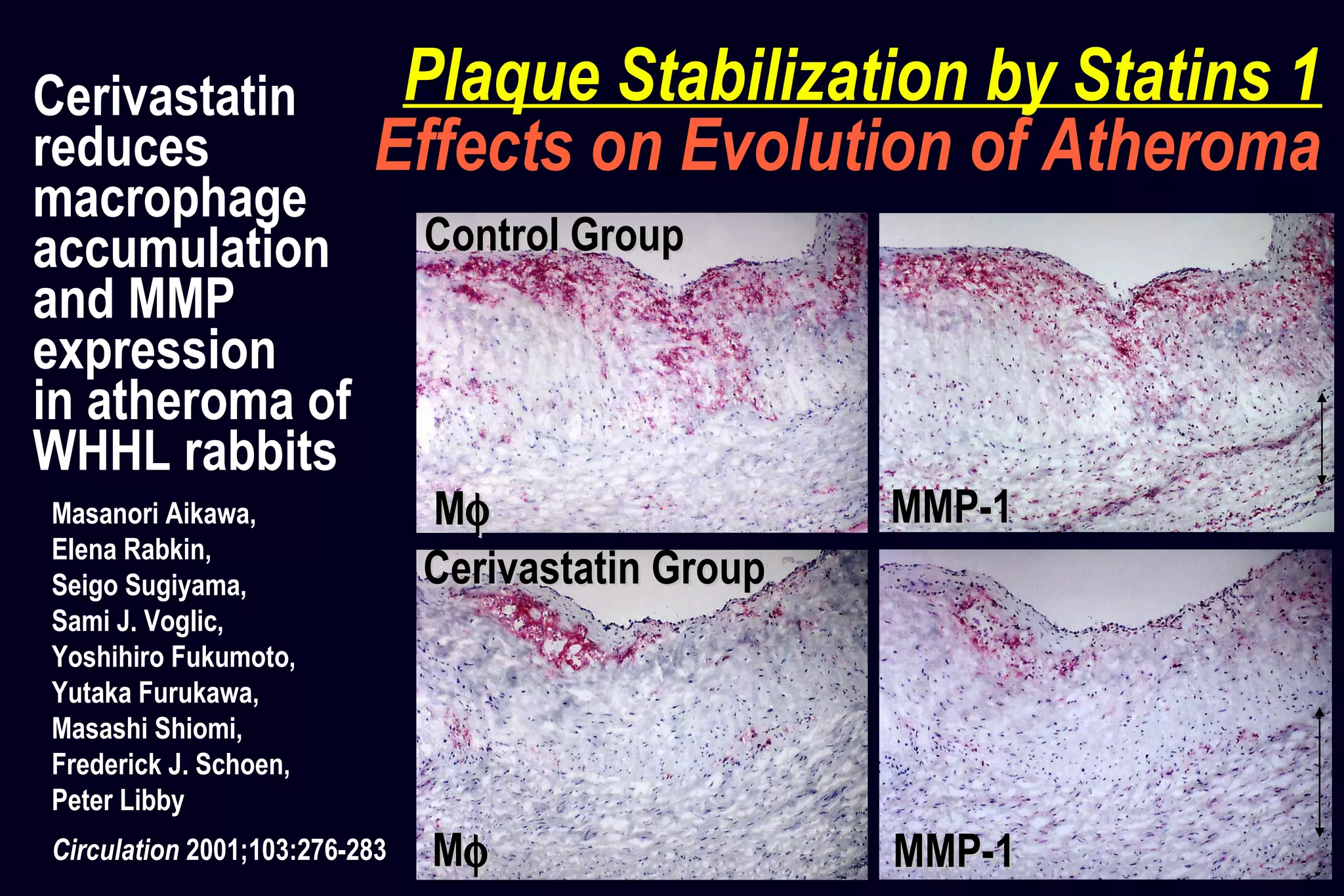 Control GroupControl Group
MMφφ MMP-1MMP-1
MMφφ MMP-1MMP-1
Cerivastatin GroupCerivastatin Group
Cerivastatin
reduces
macrophage
accumulation
and MMP
expression
in atheroma of
WHHL rabbits
Masanori Aikawa,
Elena Rabkin,
Seigo Sugiyama,
Sami J. Voglic,
Yoshihiro Fukumoto,
Yutaka Furukawa,
Masashi Shiomi,
Frederick J. Schoen,
Peter Libby
Circulation 2001;103:276-283
Plaque Stabilization by Statins 1
Effects on Evolution of Atheroma
 