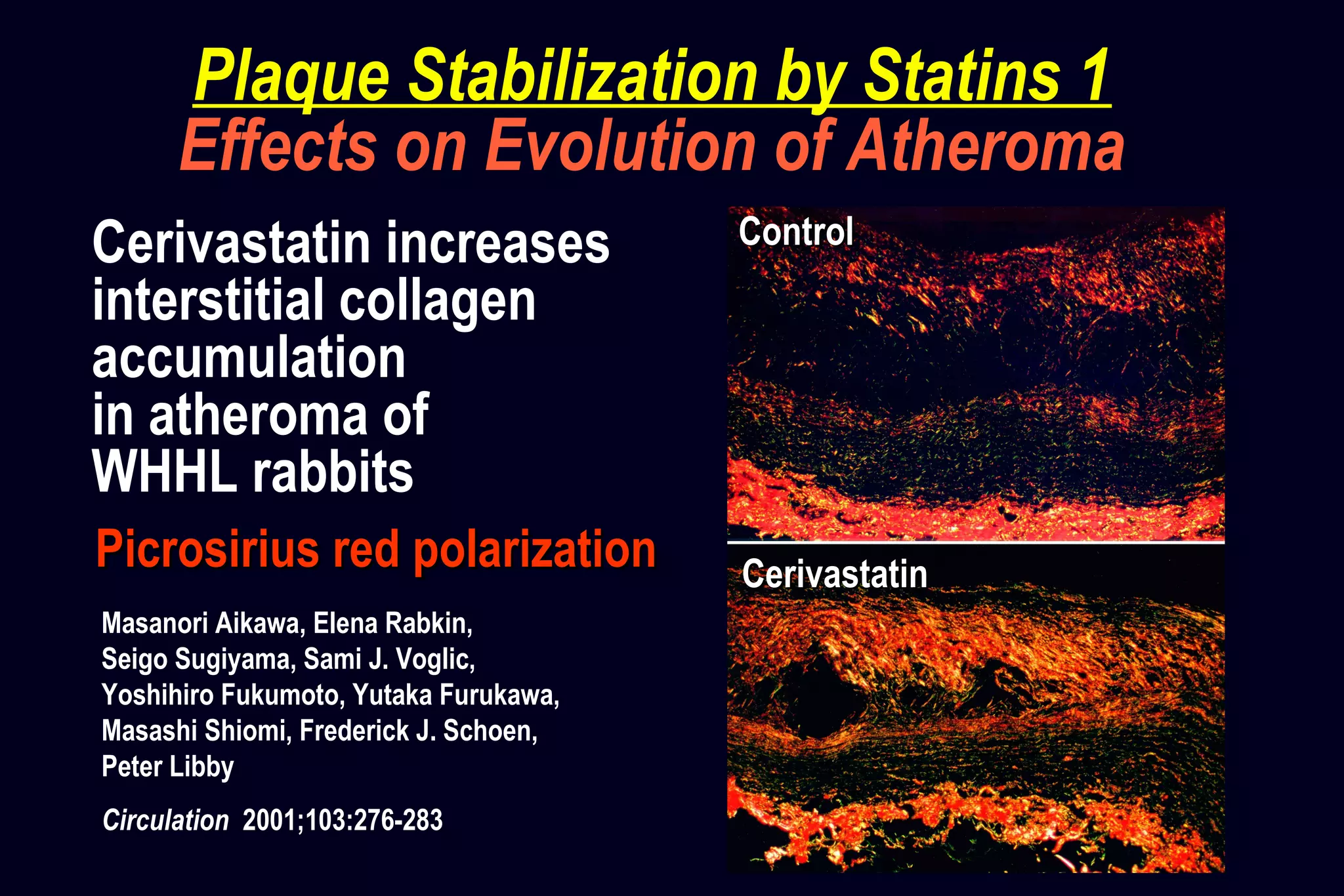 CerivastatinCerivastatin
ControlControlCerivastatin increases
interstitial collagen
accumulation
in atheroma of
WHHL rabbits
Picrosirius red polarizationPicrosirius red polarization
Masanori Aikawa, Elena Rabkin,
Seigo Sugiyama, Sami J. Voglic,
Yoshihiro Fukumoto, Yutaka Furukawa,
Masashi Shiomi, Frederick J. Schoen,
Peter Libby
Circulation 2001;103:276-283
Plaque Stabilization by Statins 1
Effects on Evolution of Atheroma
 