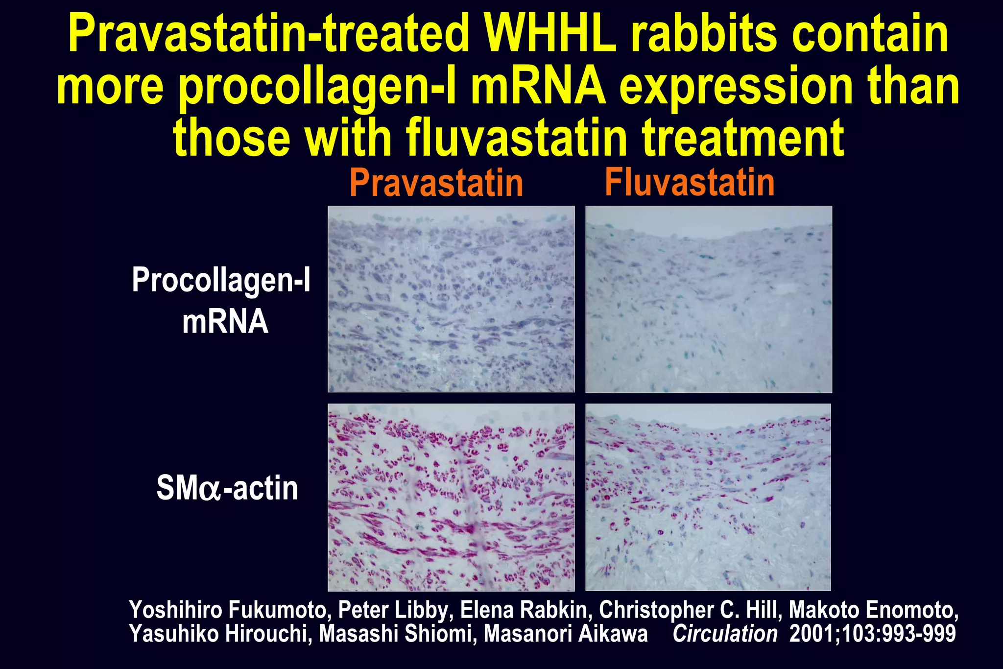 Pravastatin Fluvastatin
Procollagen-I
mRNA
SMα-actin
Pravastatin-treated WHHL rabbits contain
more procollagen-I mRNA expression than
those with fluvastatin treatment
Yoshihiro Fukumoto, Peter Libby, Elena Rabkin, Christopher C. Hill, Makoto Enomoto,
Yasuhiko Hirouchi, Masashi Shiomi, Masanori Aikawa Circulation 2001;103:993-999
 