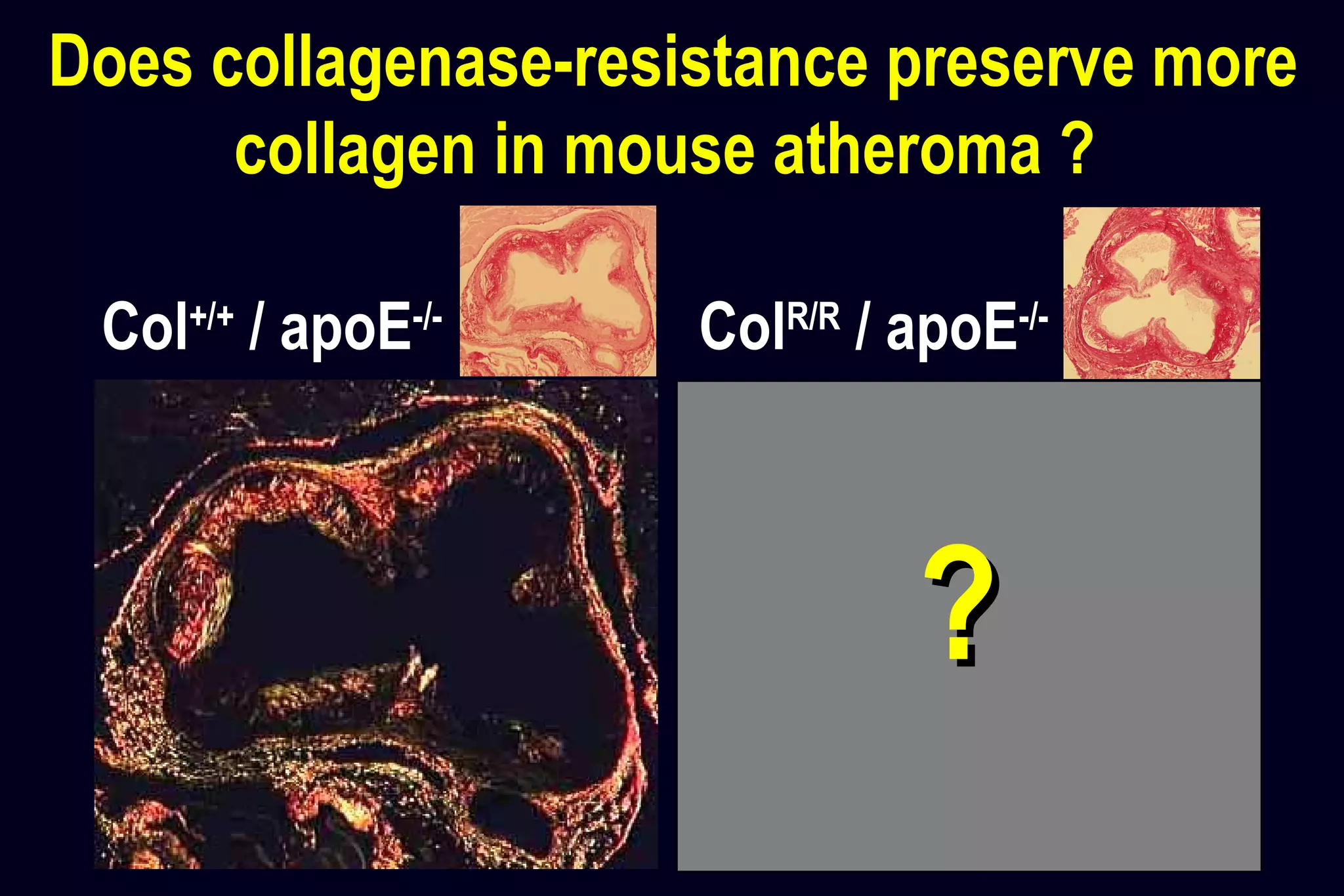 Does collagenase-resistance preserve more
collagen in mouse atheroma ?
Col+/+
/ apoE-/-
ColR/R
/ apoE-/-
??
 