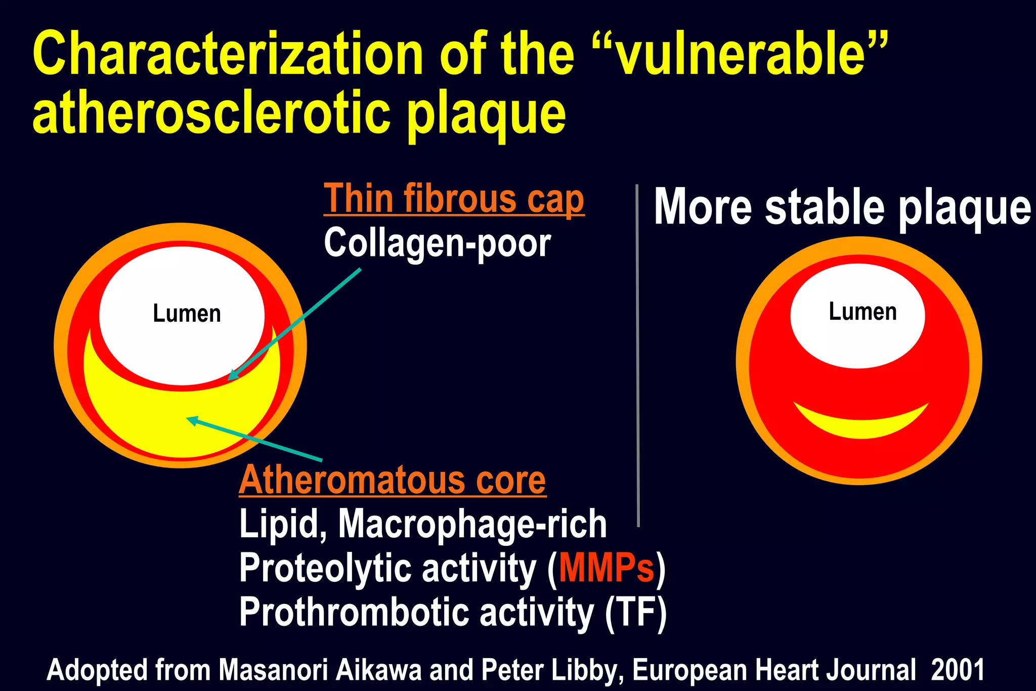 Atheromatous core
Lipid, Macrophage-rich
Proteolytic activity (MMPs)
Prothrombotic activity (TF)
Characterization of the “vulnerable”
atherosclerotic plaque
Lumen
More stable plaque
Adopted from Masanori Aikawa and Peter Libby, European Heart Journal 2001
Lumen
Thin fibrous cap
Collagen-poor
 