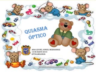 QUIASMA ÓPTICO,[object Object],ANA LID DEL ANGEL HERNANDEZ,[object Object],12 DE MAYO 2010,[object Object],OFTALMOLOGIA,[object Object]