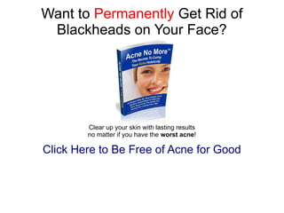 Want to Permanently Get Rid of
 Blackheads on Your Face?




        Clear up your skin with lasting results
        no matter if you have the worst acne!

Click Here to Be Free of Acne for Good
 