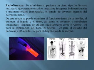Radiofármacos. Se administra al paciente un cierto tipo de fármaco
radiactivo que permite estudiar, mediante imágenes bidimensionales
o tridimensionales (tomografía), el estado de diversos órganos del
cuerpo humano.
De este modo se puede examinar el funcionamiento de la tiroides, el
pulmón, el hígado y el riñón, así como el volumen y circulación
sanguíneos. También, se utilizan radiofármacos como el Cromo - 51
para la exploración del bazo, el Selenio - 75 para el estudio del
páncreas y el Cobalto - 57 para el diagnóstico de la anemia.
 