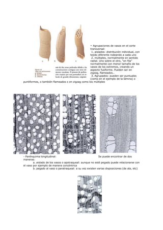 -
                                                     Agrupaciones de vasos en el corte
                                                   transversal:
                                                    1. aislados: distribución individual, con
                                                   tejido diferente rodeando a cada uno
                                                    2. múltiples, normalmente en sentido
                                                   radial. Uno sobre el otro, “en fila”
                                                   normalmente con menor tamaño de los
                                                   vasos de los extremos, creando un
                                                   aspecto fusiforme. Pueden ser en
                                                   zigzag, flameados..
                                                    3. Agrupados: pueden ser puntuales
                                                   (como en el ejemplo de la lámina) o
puntiformes, o también flameados o en zigzag como los múltiples




- Parénquima longitudinal:                                  Se puede encontrar de dos
maneras:
        a. aislado de los vasos o apotraqueal: aunque no esté pegado puede relacionarse con
el vaso por ejemplo de manera concéntrica
        b. pegado al vaso o paratraqueal: a su vez existen varias disposiciones (de ala, etc)
 