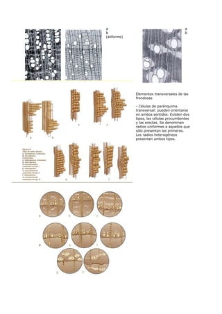 a                                        a
b                                        b
(aliforme)




             Elementos transversales de las
             frondosas

             - Células de parénquima
             transversal: pueden orientarse
             en ambos sentidos. Existen dos
             tipos, las células procumbentes
             y las erectas. Se denominan
             radios uniformes a aquellos que
             sólo presentan las primeras.
             Los radios heterogéneos
             presentan ambos tipos.
 