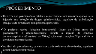 PROCEDIMENTO 
Uma vez que posicionado o cateter e o microcatéter nos ramos desejados, será 
injetado uma solução de drogas quimioterápica, seguindo de embolização 
(bloqueio da circulação) com pequenas partículas. 
 O paciente recebe lidocaína intra-arterial (bolus de 30mg antes de 
procedimento e intermitentemente durante a injeção da emulsão 
quimioterapêutica até um total de 200mg) e fentanyl e morfina IV para aliviar a 
dor durante a embolização. 
Ao final do procedimento, os cateteres e o introdutores são retirados, seguindo 
de um curativo compressivo. 
 