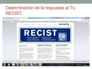 Determinación de la respuesta al Tx.
RECIST.

 