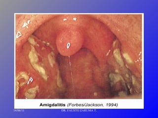 14/06/11 DR. FAUSTO ZARUMA T. 