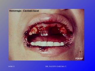 14/06/11 DR. FAUSTO ZARUMA T. 