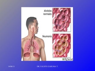 14/06/11 DR. FAUSTO ZARUMA T. 